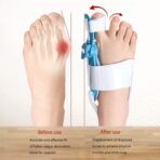 Bunion Support Splint. Valgus And Bunion Valgus, Corrector, Hallux Valgus Corrector, Adjustable Bunion Valgus Protective Cover For Men And Women - Image 3